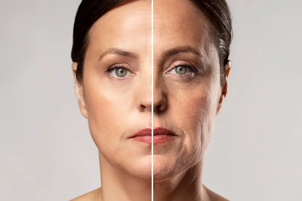 Benefits of Botox for Wrinkles