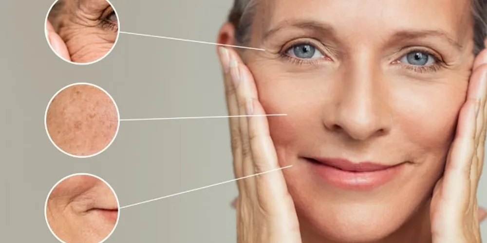 What is Biolifting Vaccine? How Does It Give Your Skin Natural Volume And Firmness?