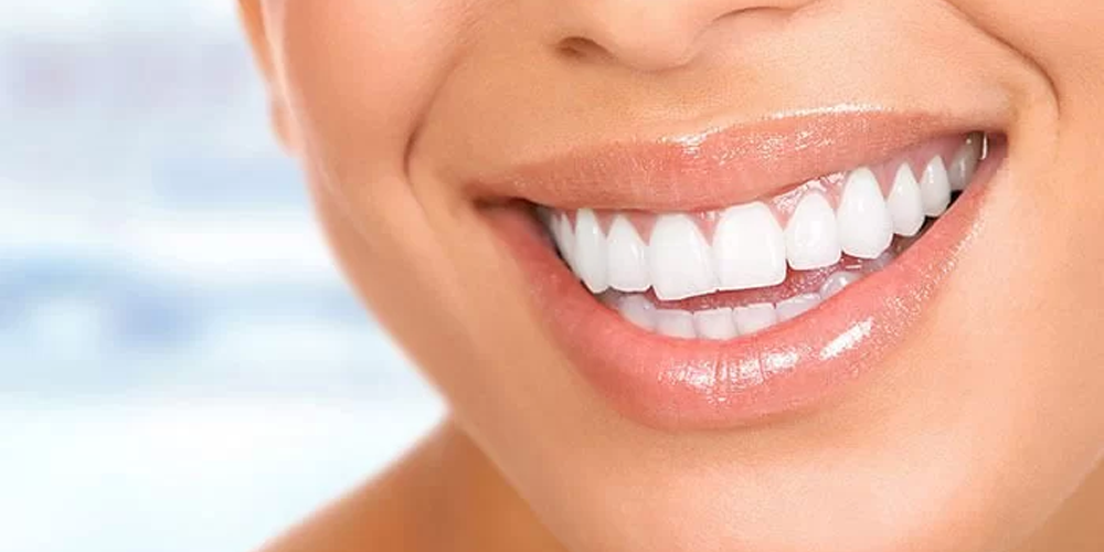 Lo sbiancamento dentale danneggia lo smalto dei denti? Gli attuali approcci scientifici %Sep% %Sitename%