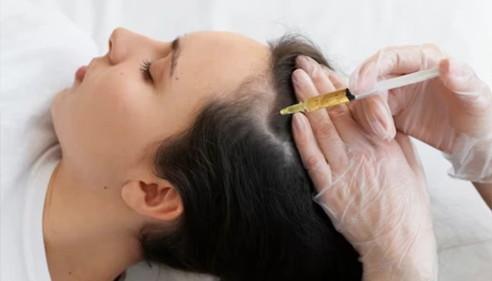 Feuille de mésothérapie 03 - Polyclinique privée Medlook