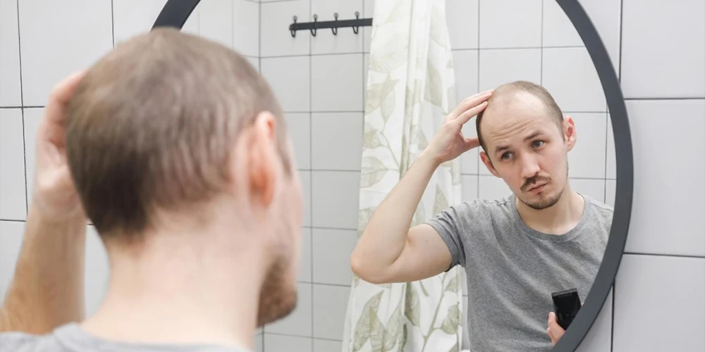 Androgenetik Alopesi Tedavisinde Saç Mezoterapisinin Rolü İstanbul