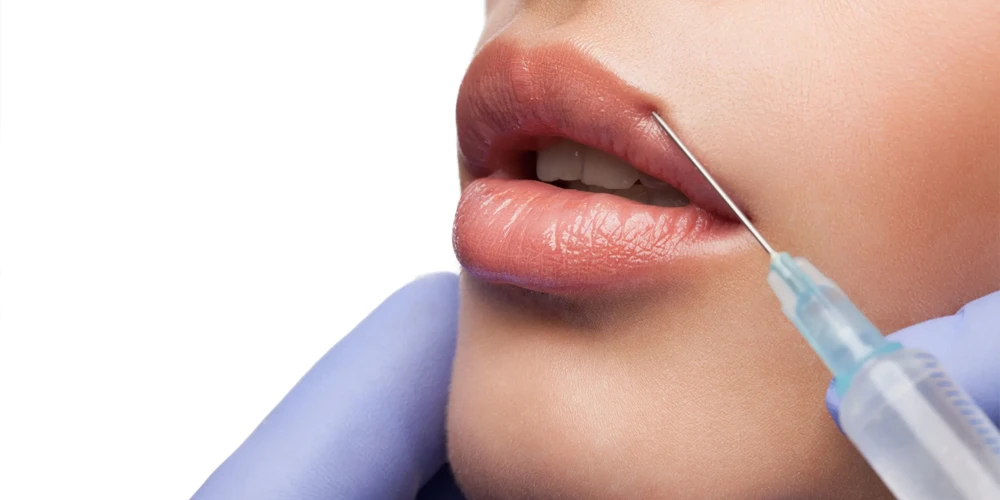 Equivoci sul riempimento delle labbra: Vincere le paure