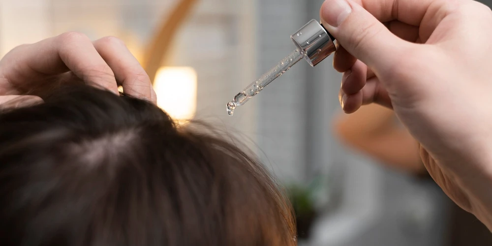 Capelli sani e rigogliosi con la mesoterapia per capelli