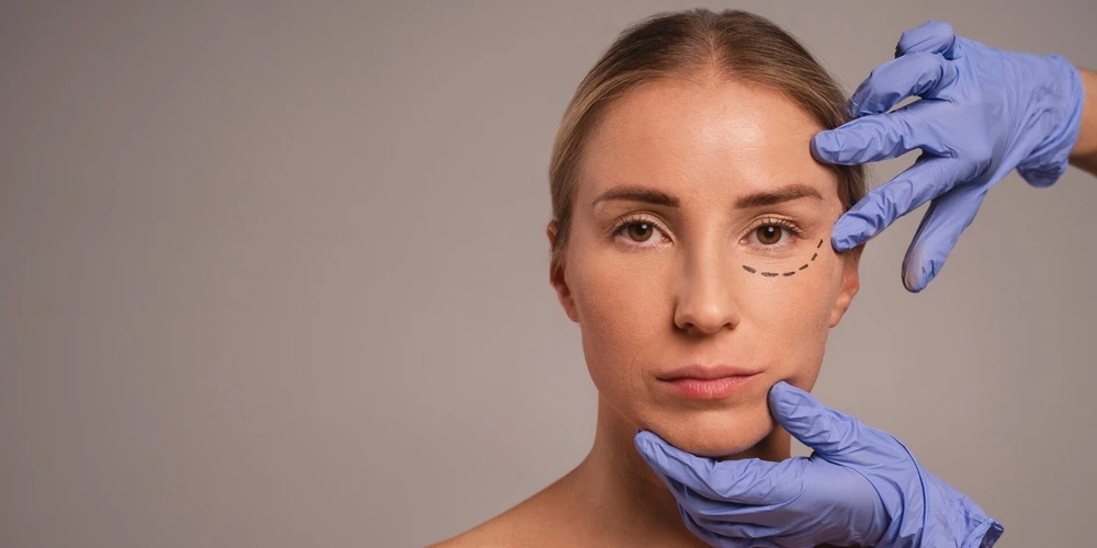 Under Eye Dark Circles and Nomor Mesotherapy Effect