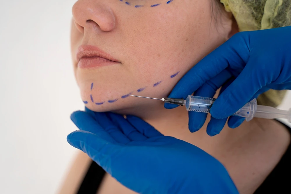 3 25 - Özel Medlook Polikliniği Gıdı Liposuction Sonrası Cilt Sarkması Olur Mu?