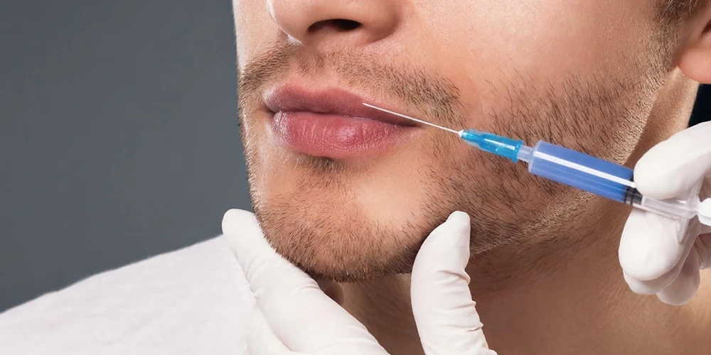 Filler labbra uomo Tocchi naturali e strategici che aumentano l'attrattività3 - Poliambulatorio privato Medlook Filler labbra uomo Tocchi naturali e strategici che aumentano l'attrattività3 - Poliambulatorio privato Medlook