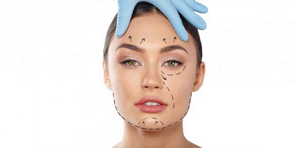 Kantoplasti Ve Badem Goz Estetigi Ile Ust Goz Kapagi Ameliyatinin Kombinasyonu2 - Özel Medlook Polikliniği Kantoplasti Ve Badem Göz Estetiği Ile Üst Göz Kapağı Ameliyatının Kombinasyonu2