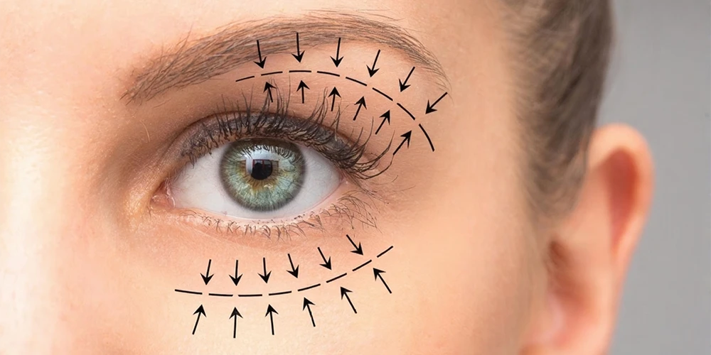 La chirurgia della palpebra superiore influisce sul campo visivo Processo di recupero funzionale e fatti scientifici3 - Özel Medlook Polikliniği La chirurgia della palpebra superiore influisce sul campo visivo Processo di recupero funzionale e fatti scientifici3 - Özel Medlook Polikliniği