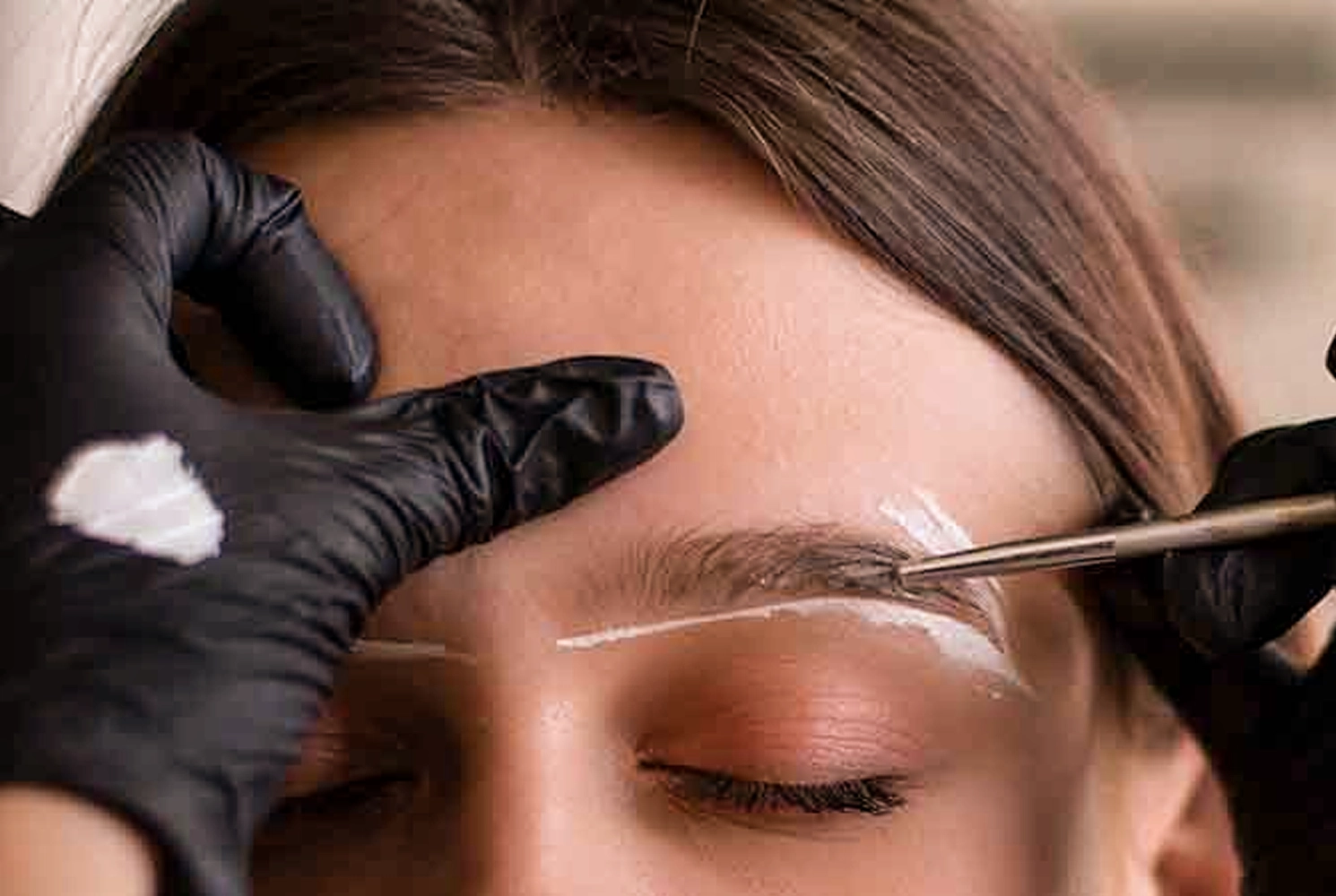 Sieht eine Augenbrauentransplantation natürlich aus? Richtungs- und Winkelplanung | Medlook