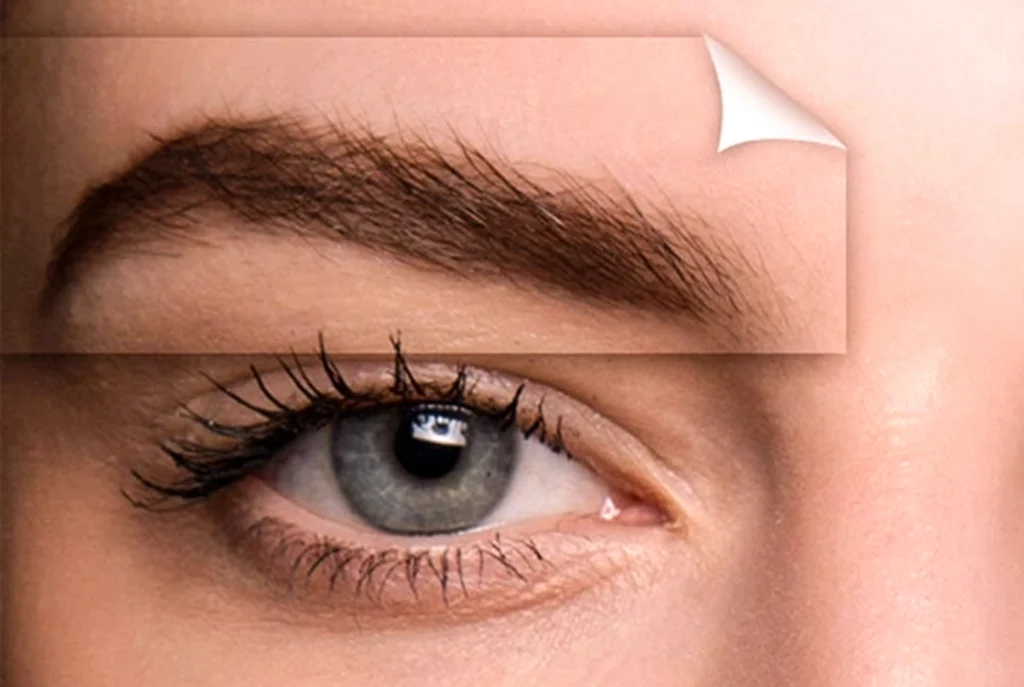 Qu'est-ce que la greffe de sourcils ? Prix et procédure | Medlook Istanbul