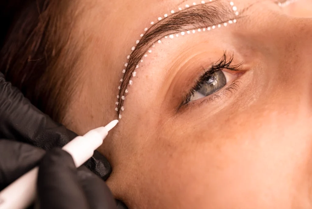 Recovery Process And Care Guide After Eyebrow Transplant | Medlook