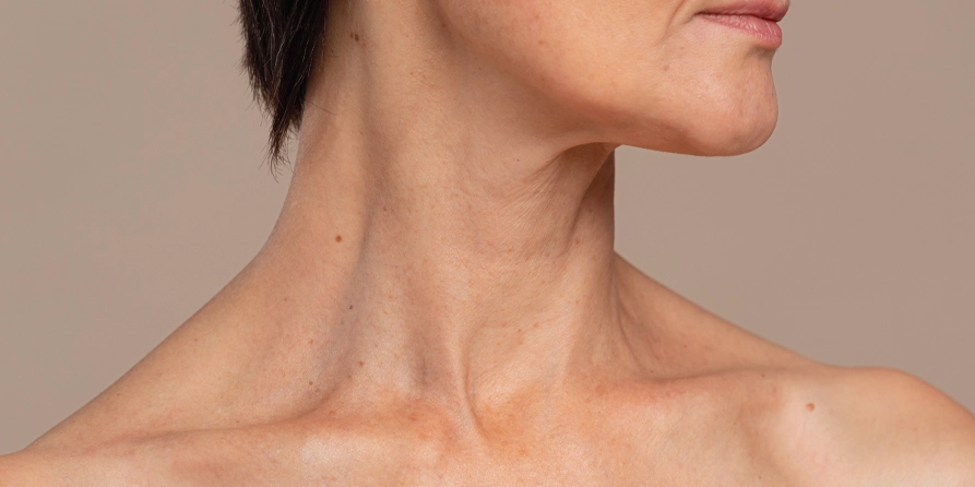 Boyun Botoksu | Nefertiti Lift &Amp; Boyun Çizgileri | Medlook