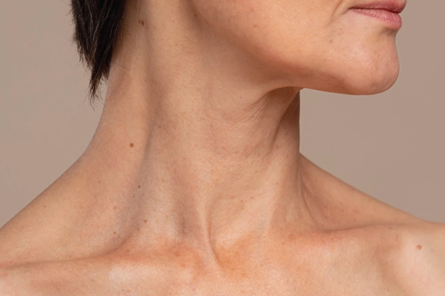 Botox du cou